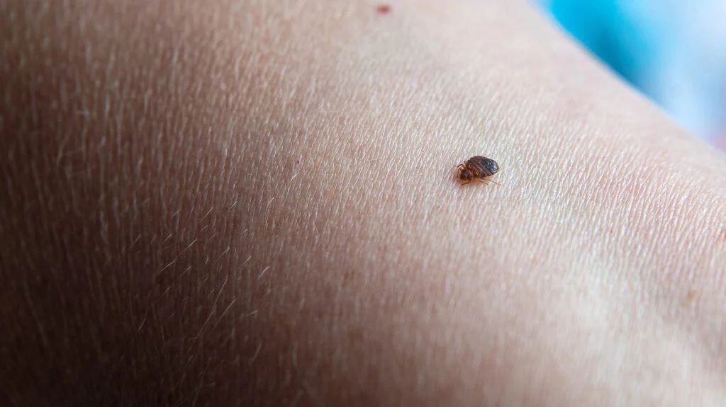 How to treat a bed bug bite. 