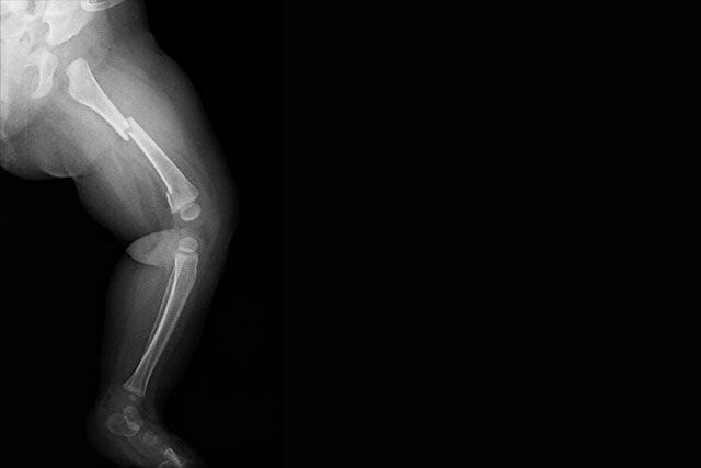 DR. JUAN CARLOS TORRES ARCHILA  