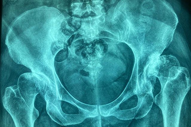 DR. JUAN CARLOS TORRES ARCHILA  