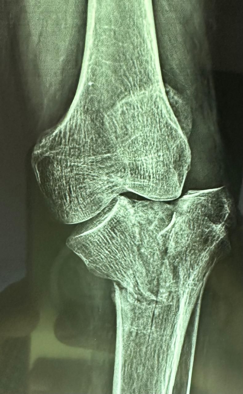 DR. JUAN CARLOS TORRES ARCHILA  