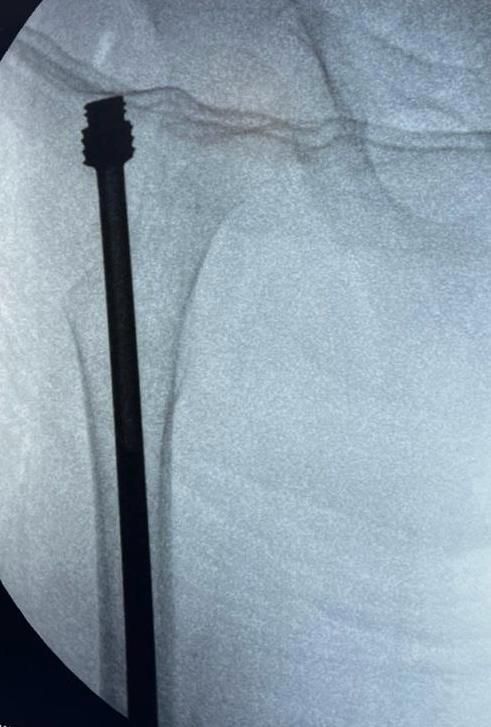 DR. JUAN CARLOS TORRES ARCHILA  