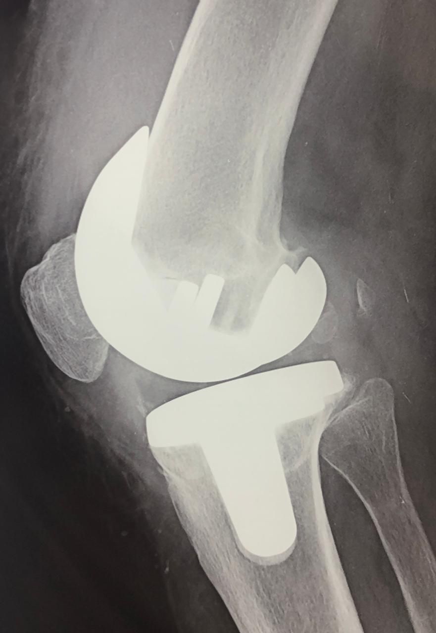 DR. JUAN CARLOS TORRES ARCHILA  