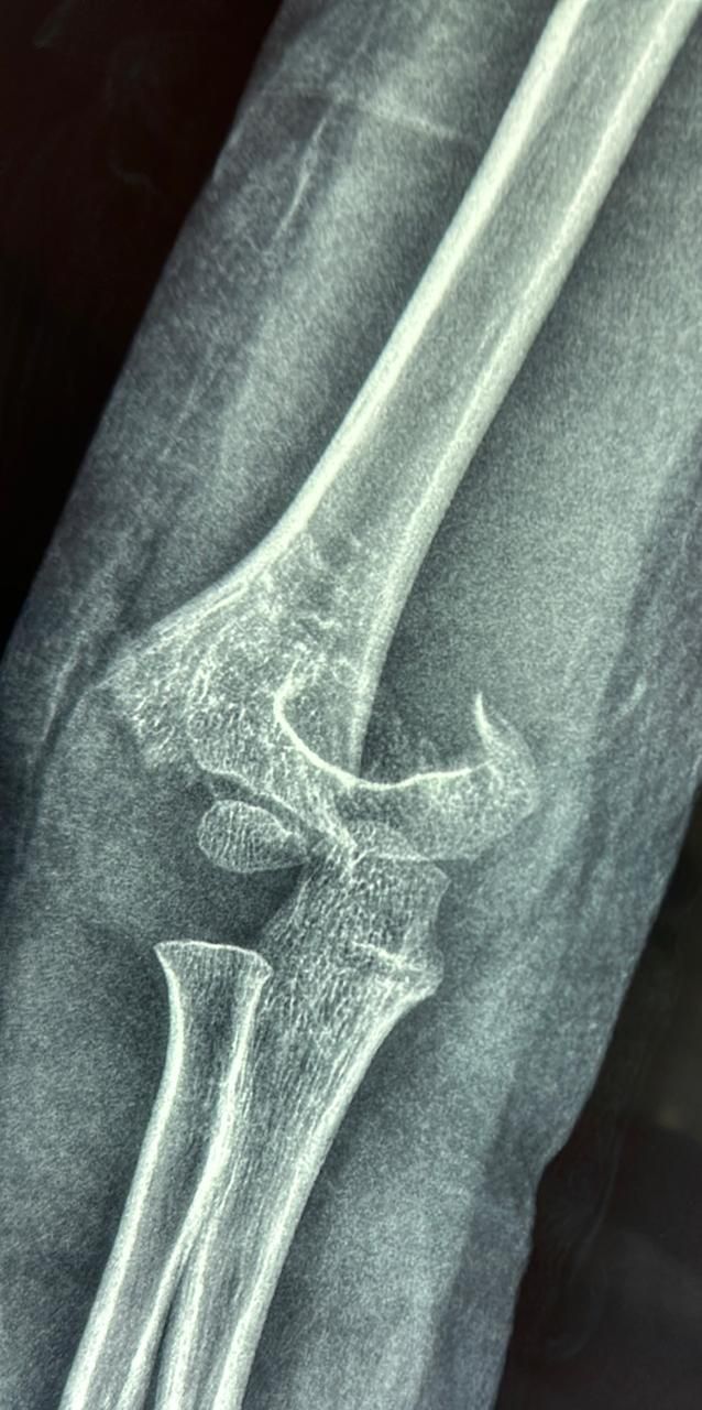 DR. JUAN CARLOS TORRES ARCHILA  