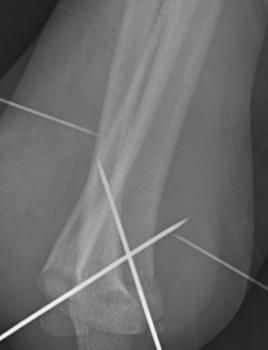 DR. JUAN CARLOS TORRES ARCHILA  