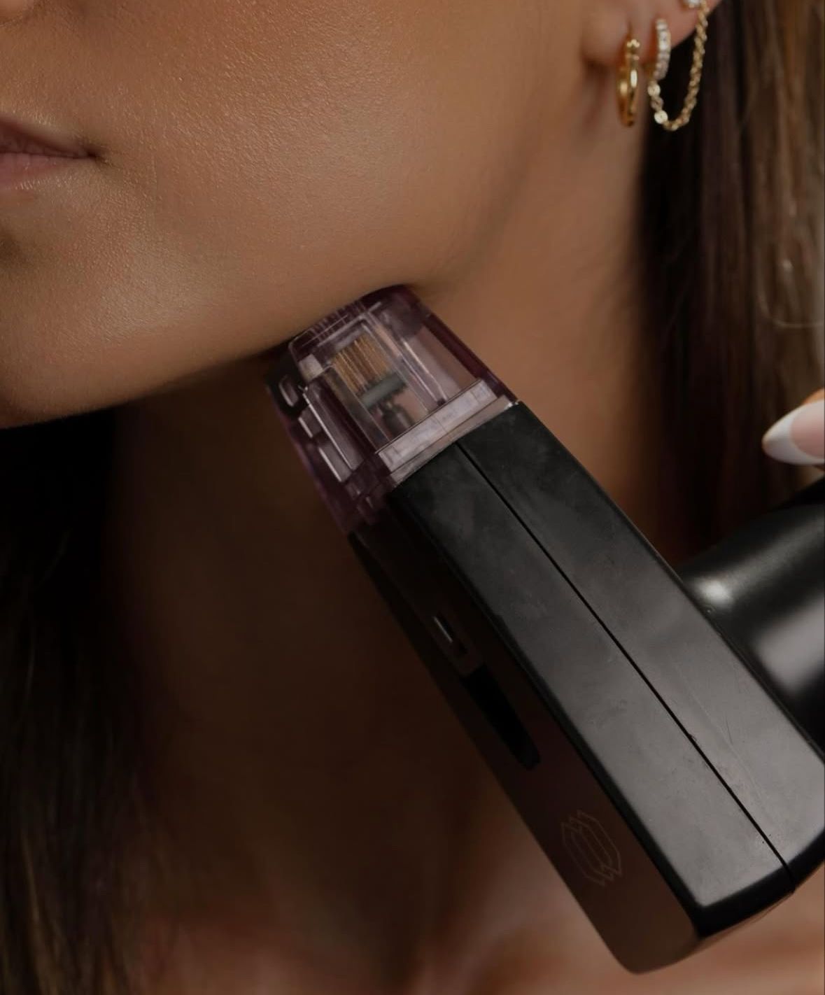 Person receiving skin treatment on their jaw with a black handheld device.