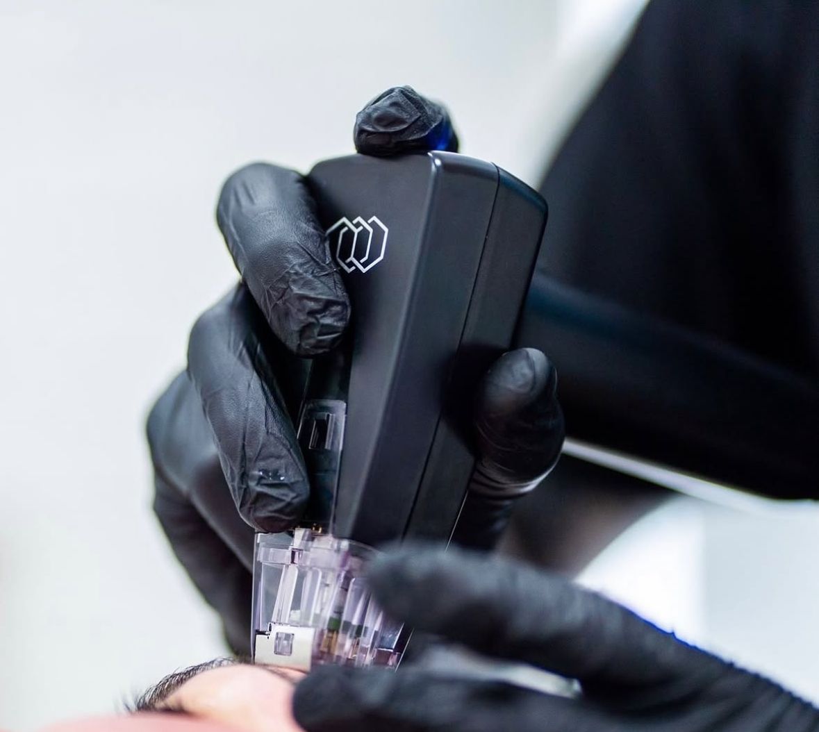 Person in black gloves holding a black device over someone's face for a skin treatment.