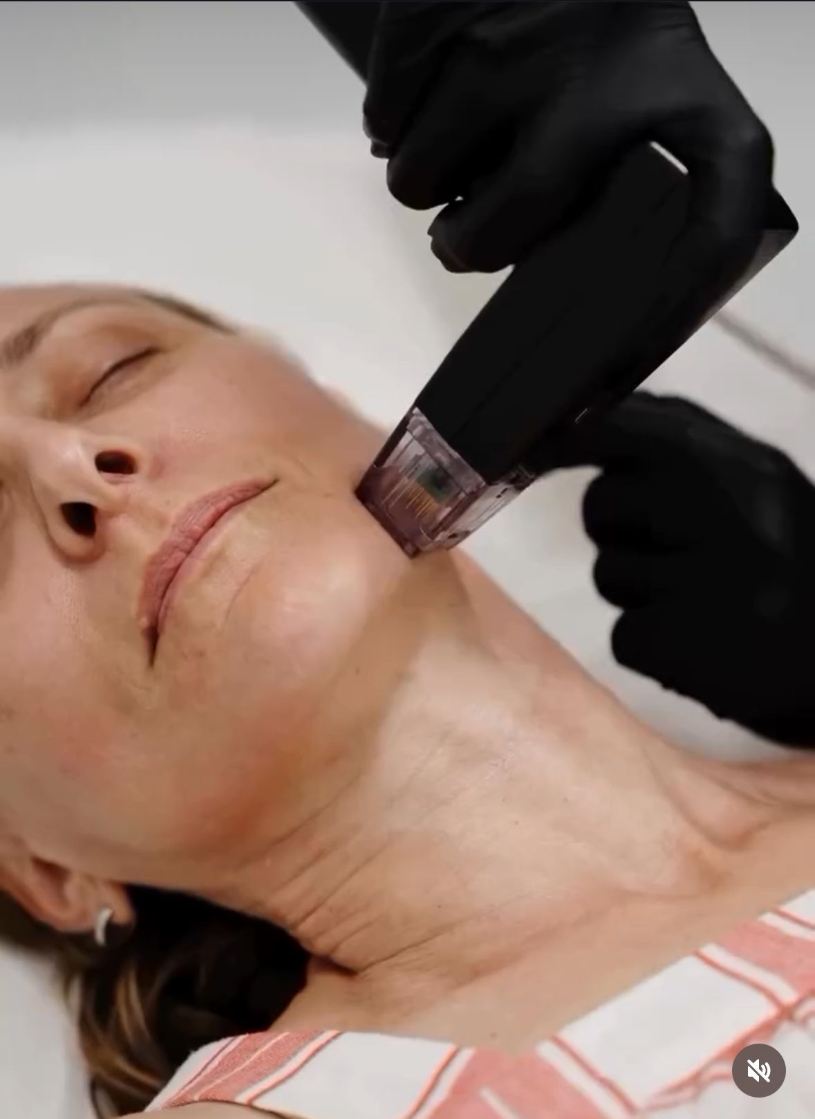 Woman receiving a facial treatment with a device on her cheek, indoors.
