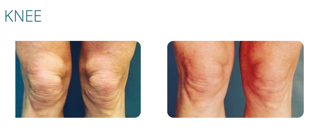 Two sets of knees, labeled 