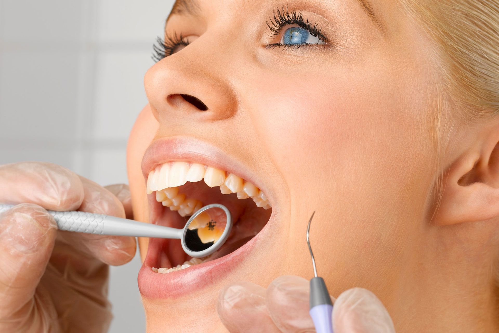 chirurgia dentale, cura della carie