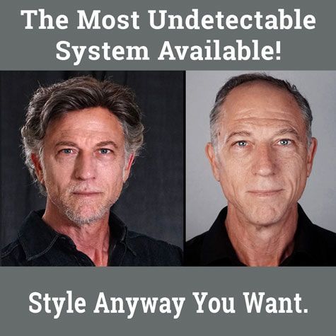 Most undetectable hair system available European Hair Institute