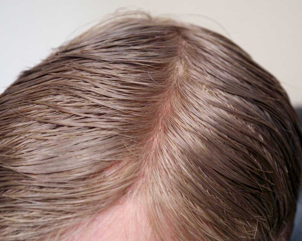 Polymer Hair Piece closeup