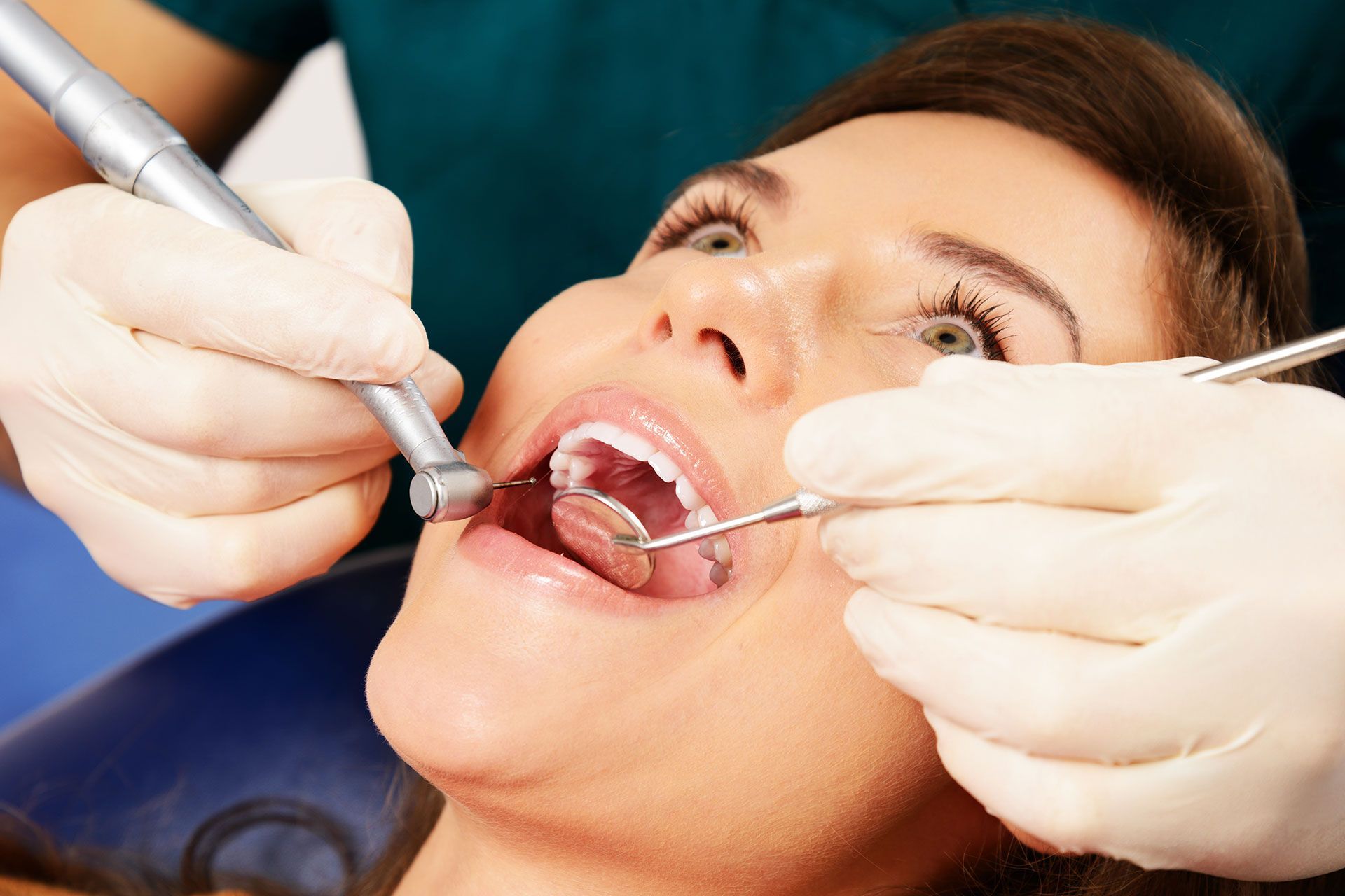 What is the Lifespan of a Root Canal