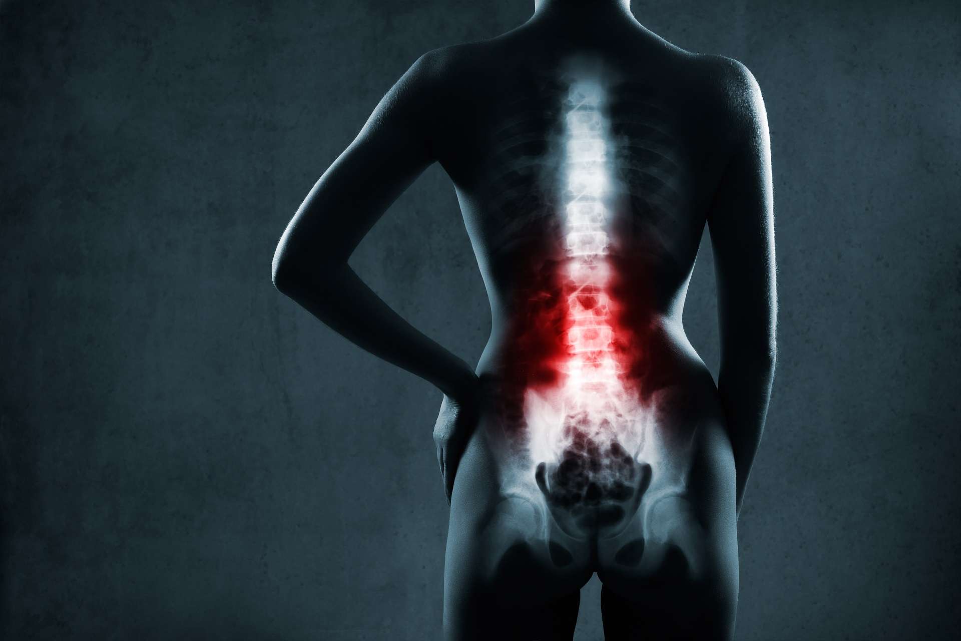 Why a Life Care Plan is So Important for Spinal Injuries?