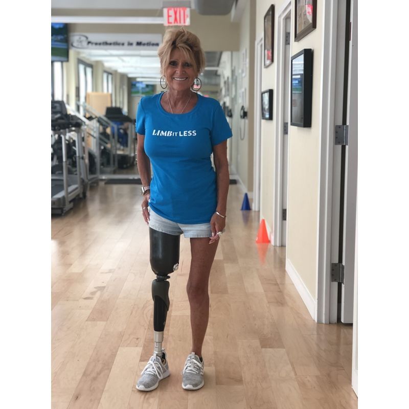 A woman with a prosthetic leg is standing in a hallway.