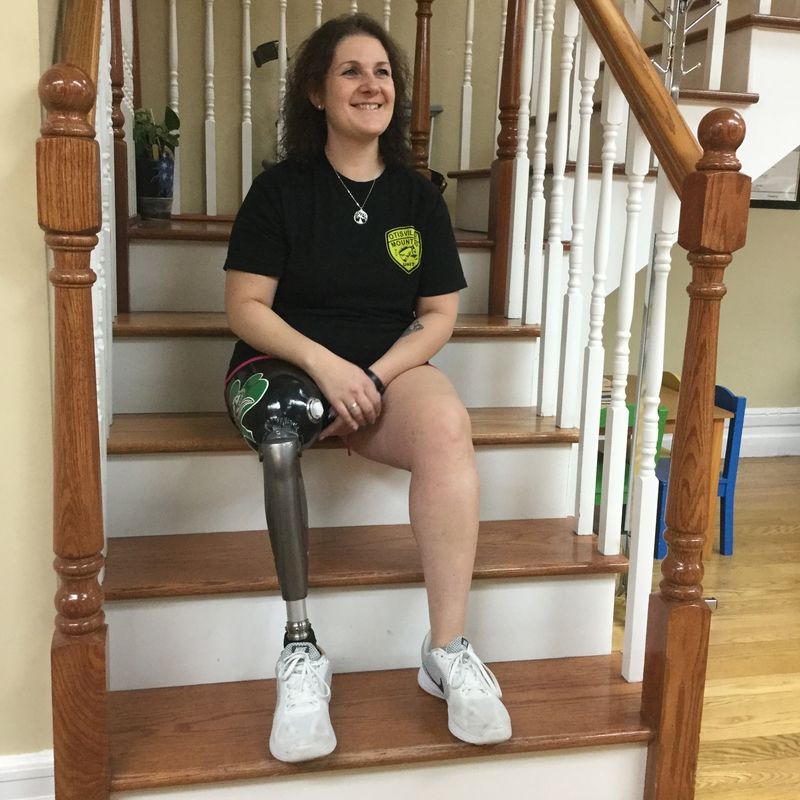 A woman with a prosthetic leg is sitting on a set of stairs