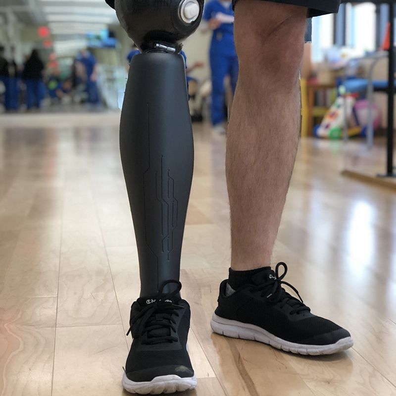 A person with a prosthetic leg is wearing black shoes