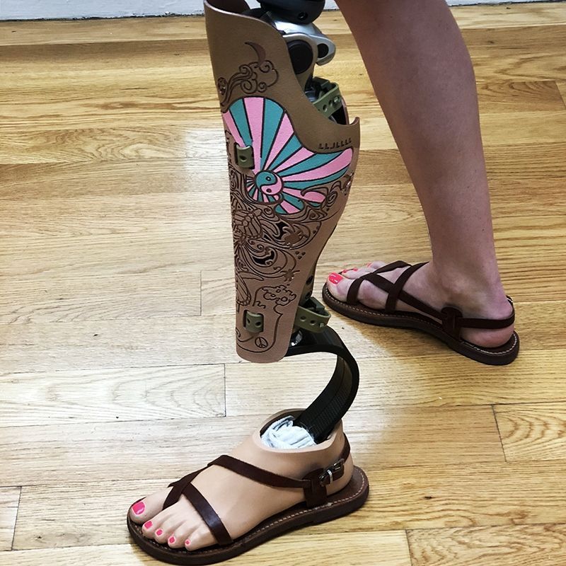 A woman is wearing a prosthetic leg and sandals
