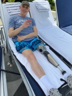 A man with a prosthetic leg is laying on a lawn chair