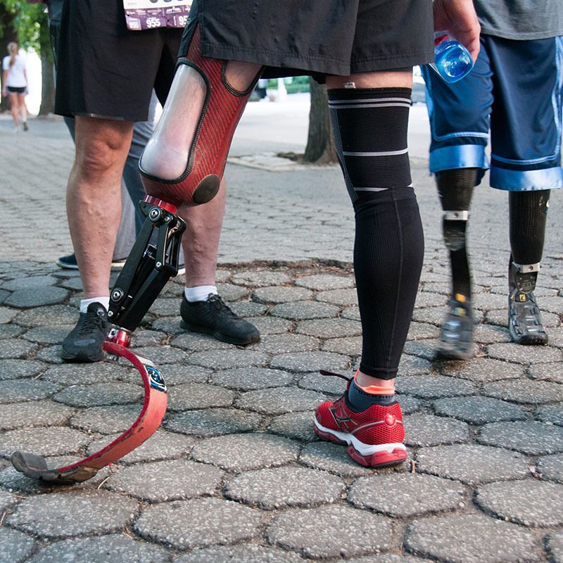 A group of people with prosthetic legs standing on a sidewalk