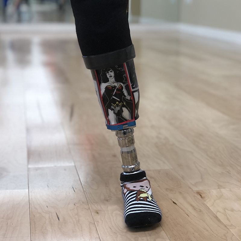A person with a prosthetic leg has wonder woman on it