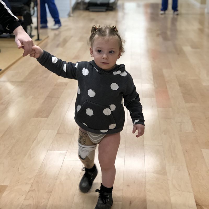 A little girl with a prosthetic leg is holding someone 's hand