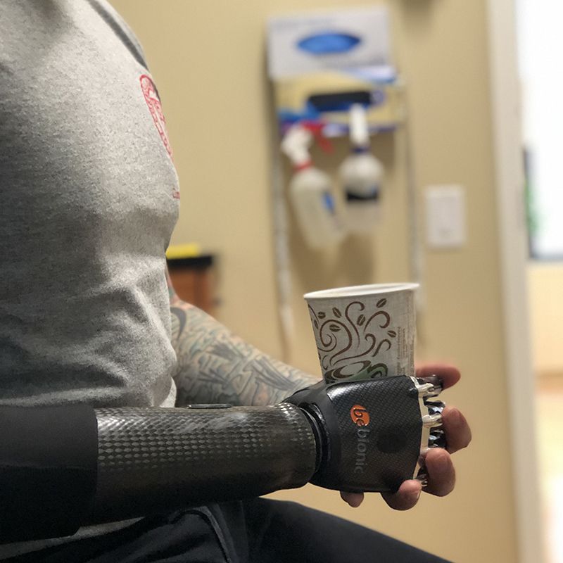 A person with a prosthetic arm is holding a cup of coffee