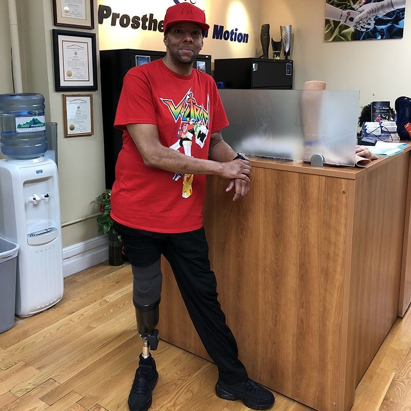 A man with a prosthetic leg is leaning against a wooden counter