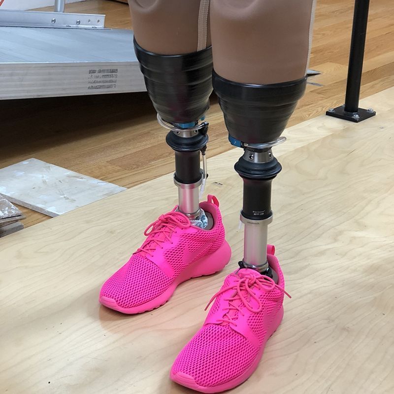 A person with prosthetic legs wearing pink shoes