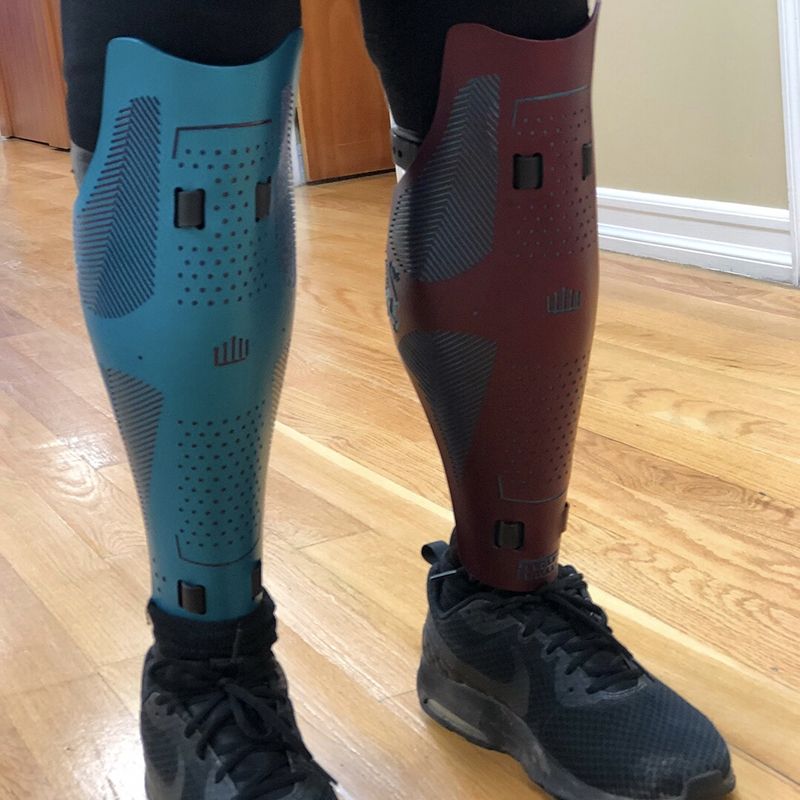 A person with a prosthetic leg is wearing a pair of nike shoes