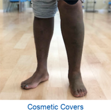 A person with cosmetic covers on their legs