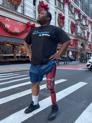 A man with a prosthetic leg is crossing the street