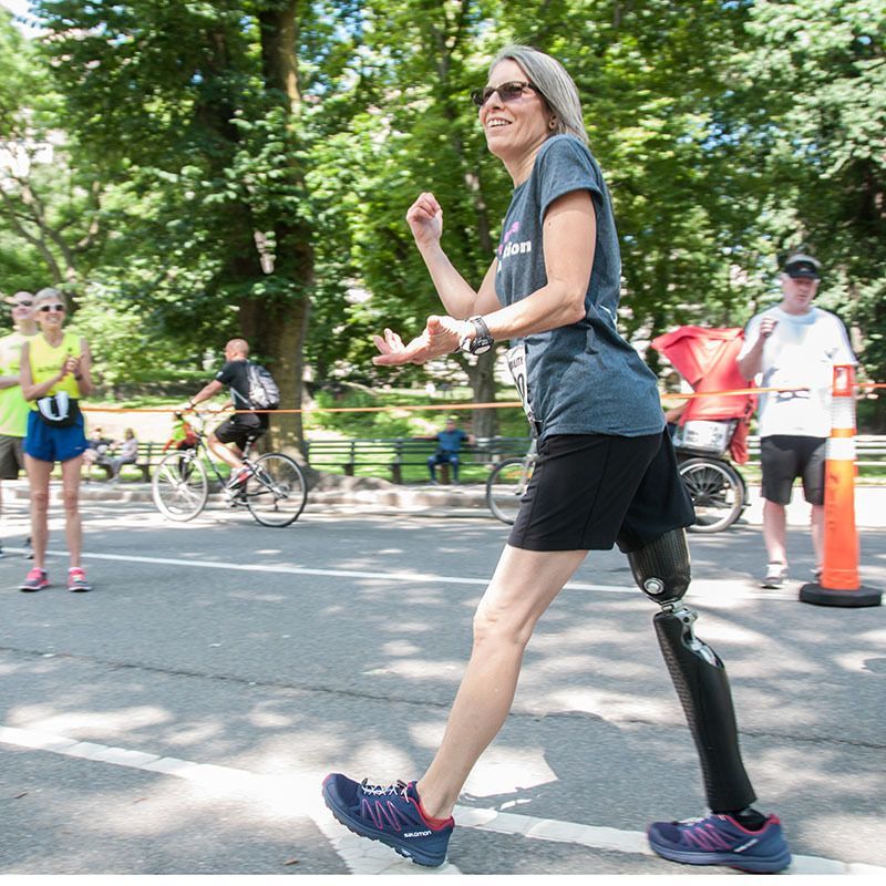 A woman with a prosthetic leg is walking down the street