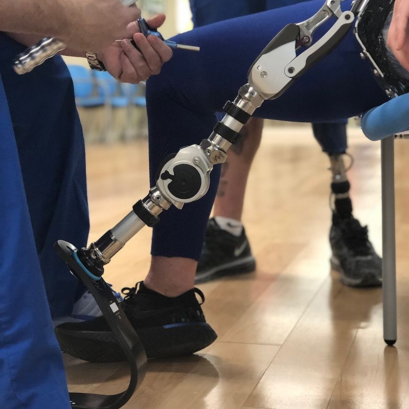 A person with a prosthetic leg is sitting in a chair