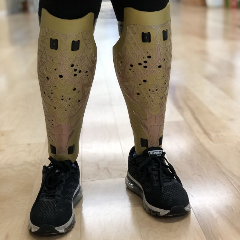 A person with a prosthetic leg is wearing black shoes