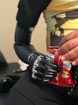 A person with a prosthetic arm is holding a bag of chips