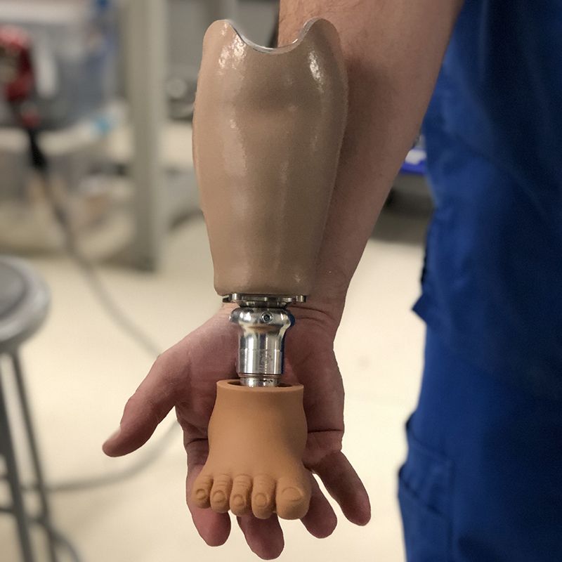 A person is holding a prosthetic arm and foot