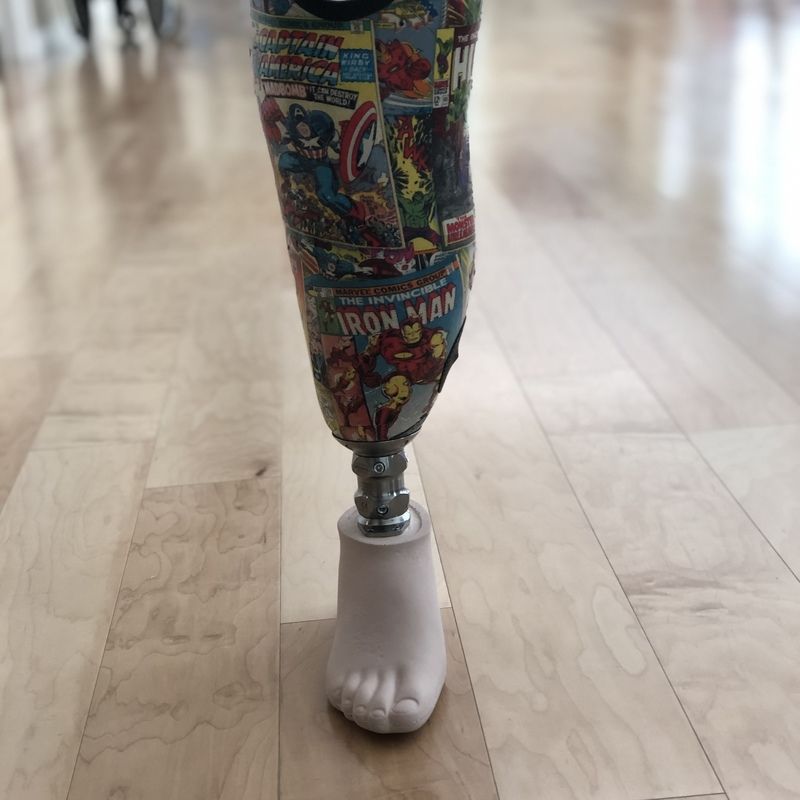 A prosthetic leg with iron man on it