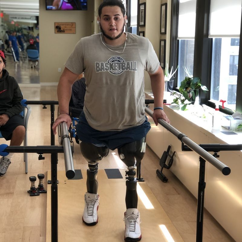 A man with a prosthetic leg wearing a basketball shirt