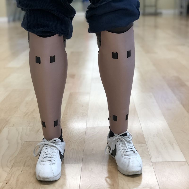 A person wearing a prosthetic leg and nike shoes