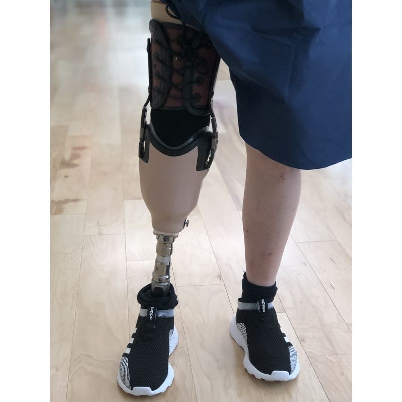 A person with a prosthetic leg is wearing black shoes