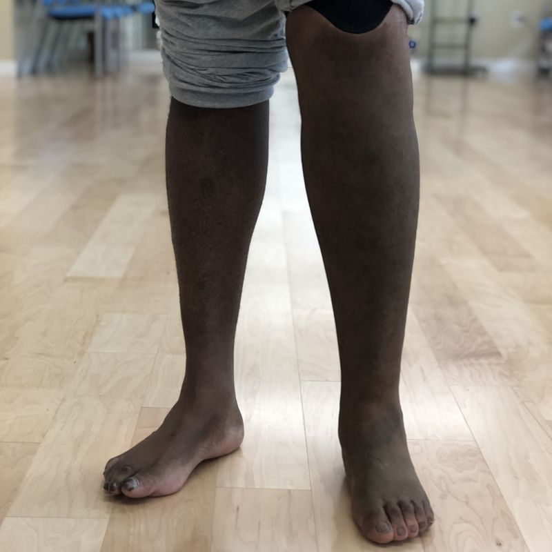A person with a prosthetic leg standing on a wooden floor