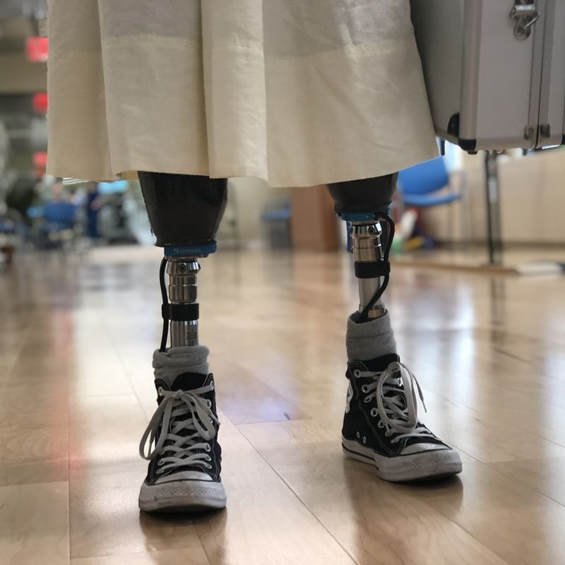 A person with prosthetic legs wearing converse shoes