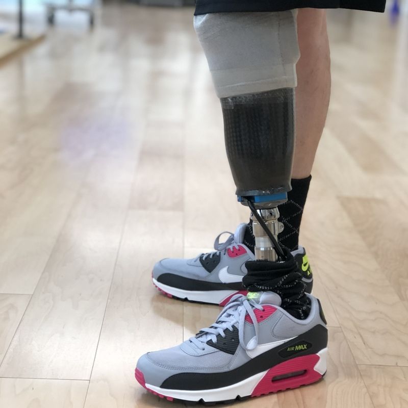 A person with a prosthetic leg wearing nike shoes