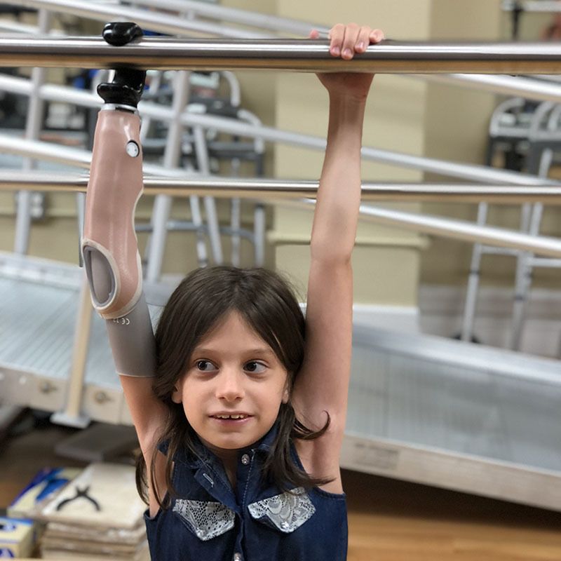A young girl with a prosthetic arm hangs from a bar