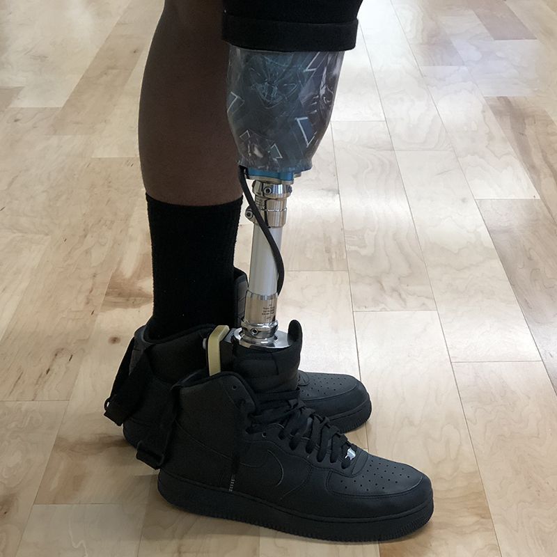 A person with a prosthetic leg wearing black shoes