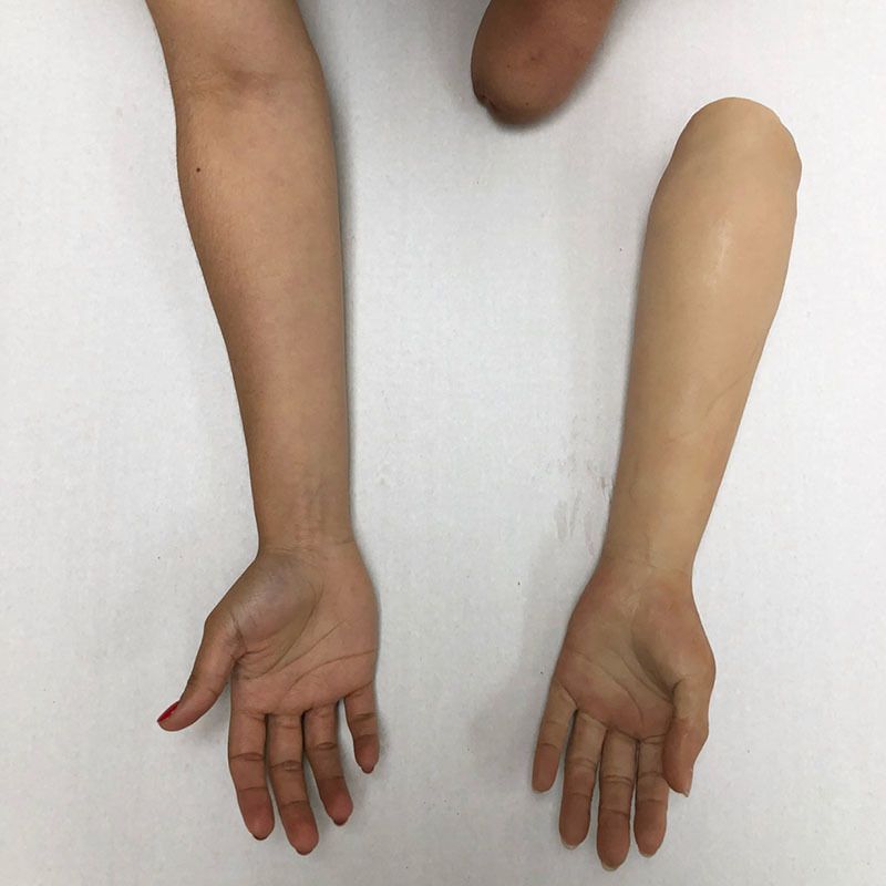 A woman 's arms with a prosthetic arm on a white surface