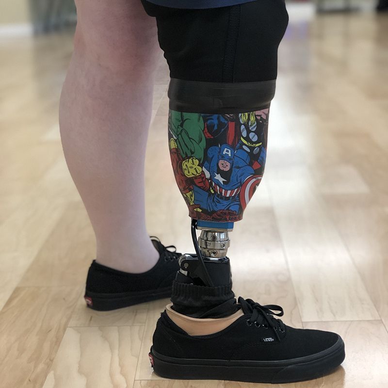A person with a prosthetic leg is wearing black vans shoes