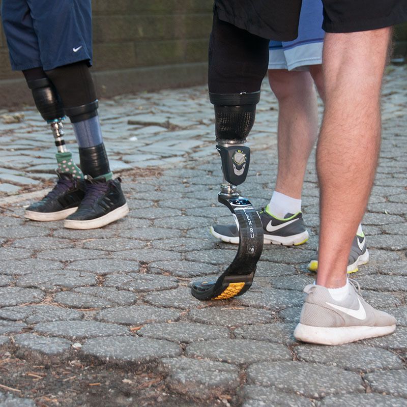 A bilateral amputee and another amputee with a vacuum and socket prosthesis.