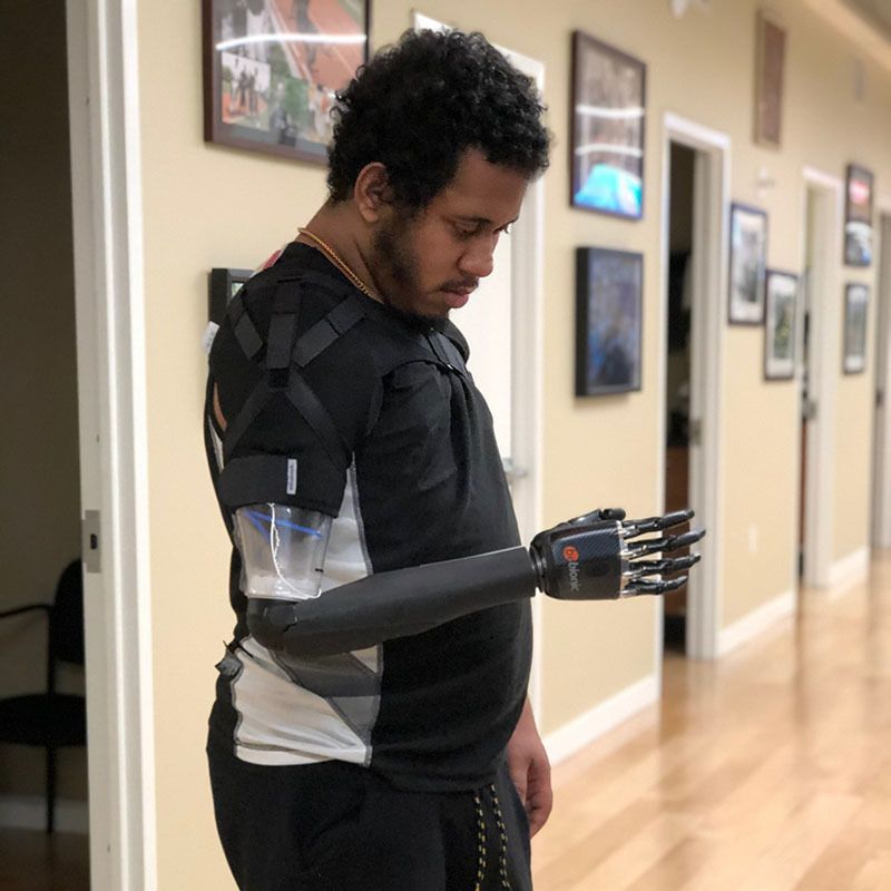 A man with a prosthetic arm is standing in a hallway