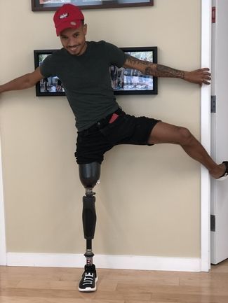 A man with a prosthetic leg is leaning against a wall.